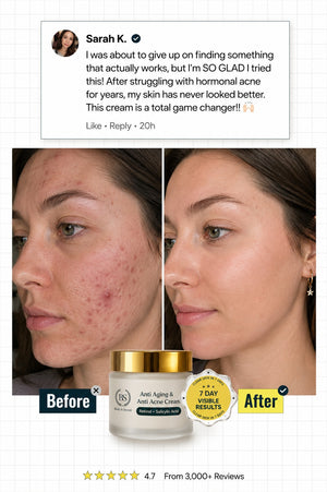 2 in 1 Anti Acne & Anti Aging Brightening Cream