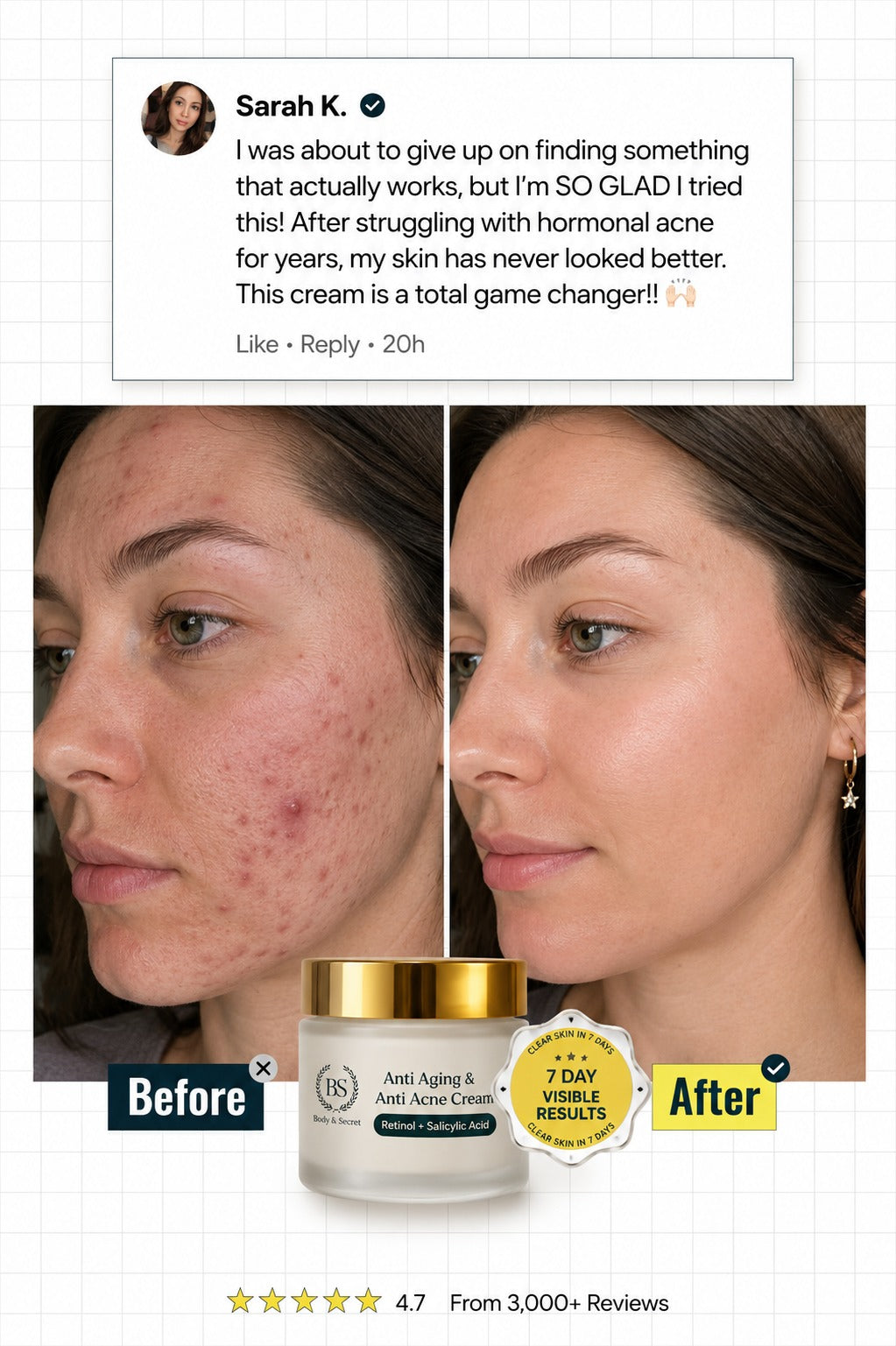 2 in 1 Anti Acne & Anti Aging Brightening Cream
